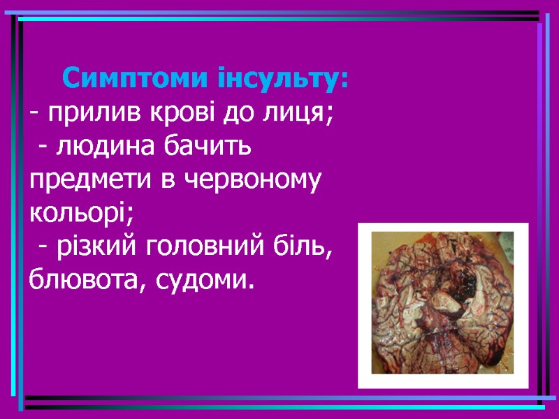 Симптоми інсульту:  - прилив крові до лиця;  - людина бачить  предмети